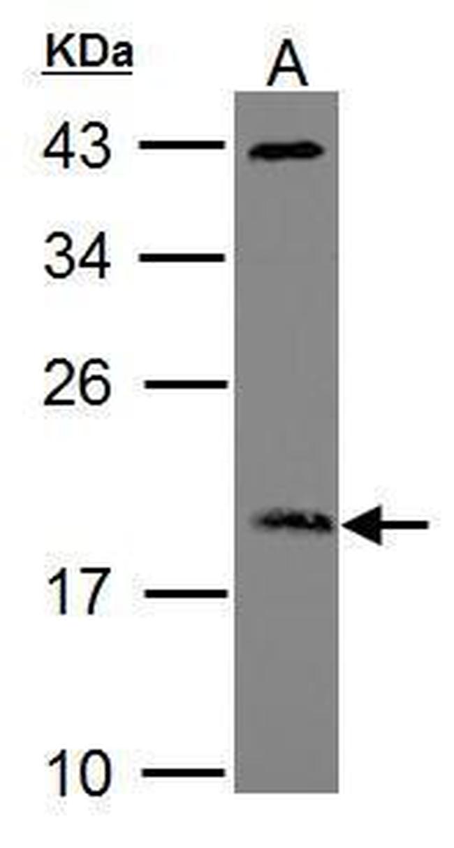 ARF3 Antibody in Western Blot (WB)