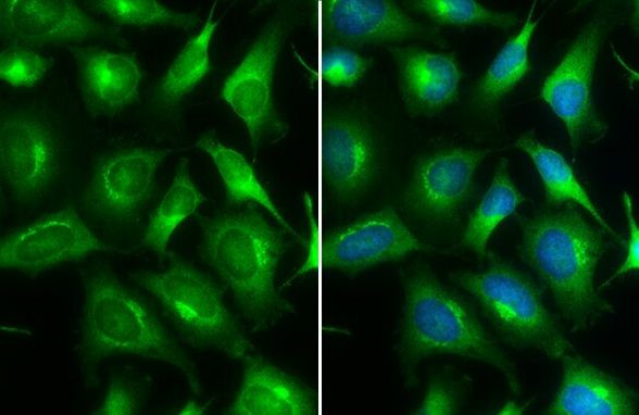 ARF5 Antibody in Immunocytochemistry (ICC/IF)