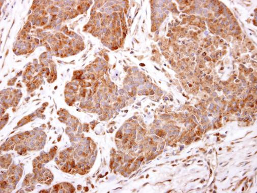 ARF5 Antibody in Immunohistochemistry (Paraffin) (IHC (P))