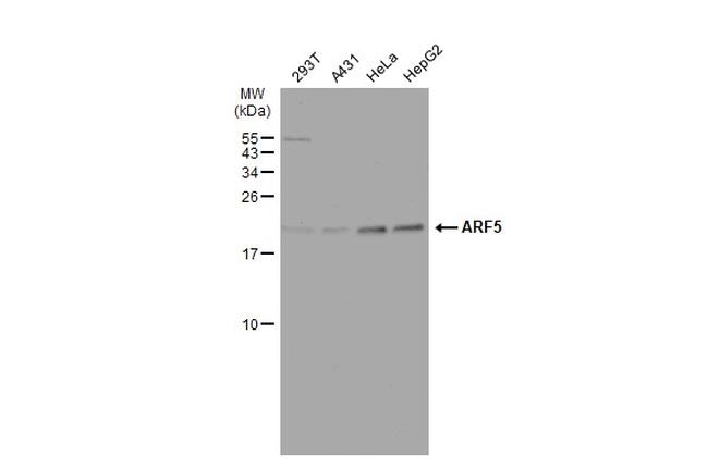 ARF5 Antibody in Western Blot (WB)