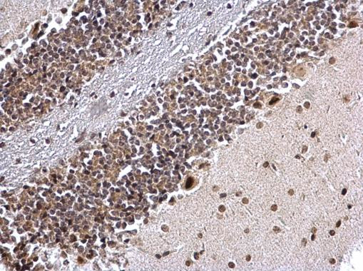 NR2F1 Antibody in Immunohistochemistry (Paraffin) (IHC (P))