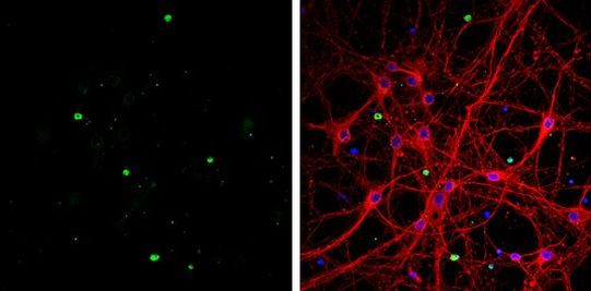 OLIG1 Antibody in Immunocytochemistry (ICC/IF)