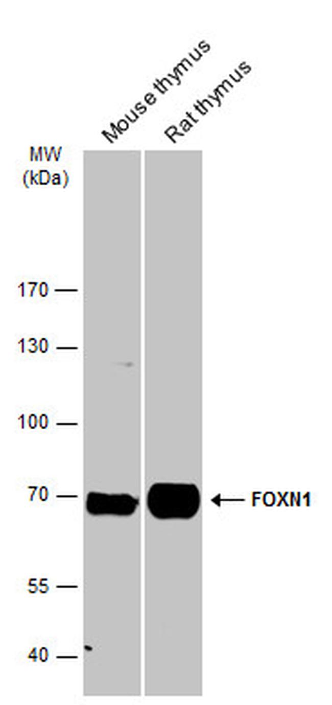 FOXN1 Antibody in Western Blot (WB)