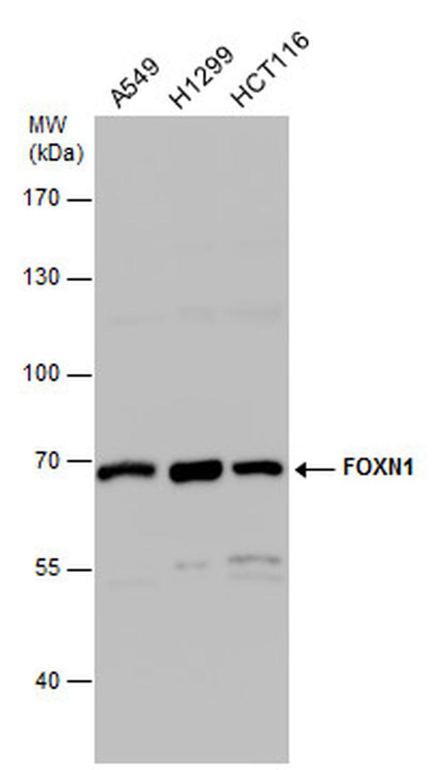 FOXN1 Antibody in Western Blot (WB)