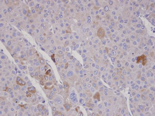 FBXO2 Antibody in Immunohistochemistry (Paraffin) (IHC (P))