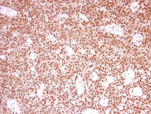 PRPF39 Antibody in Immunohistochemistry (Paraffin) (IHC (P))