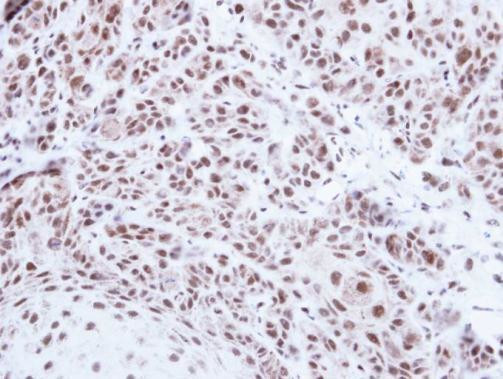 PRPF39 Antibody in Immunohistochemistry (Paraffin) (IHC (P))