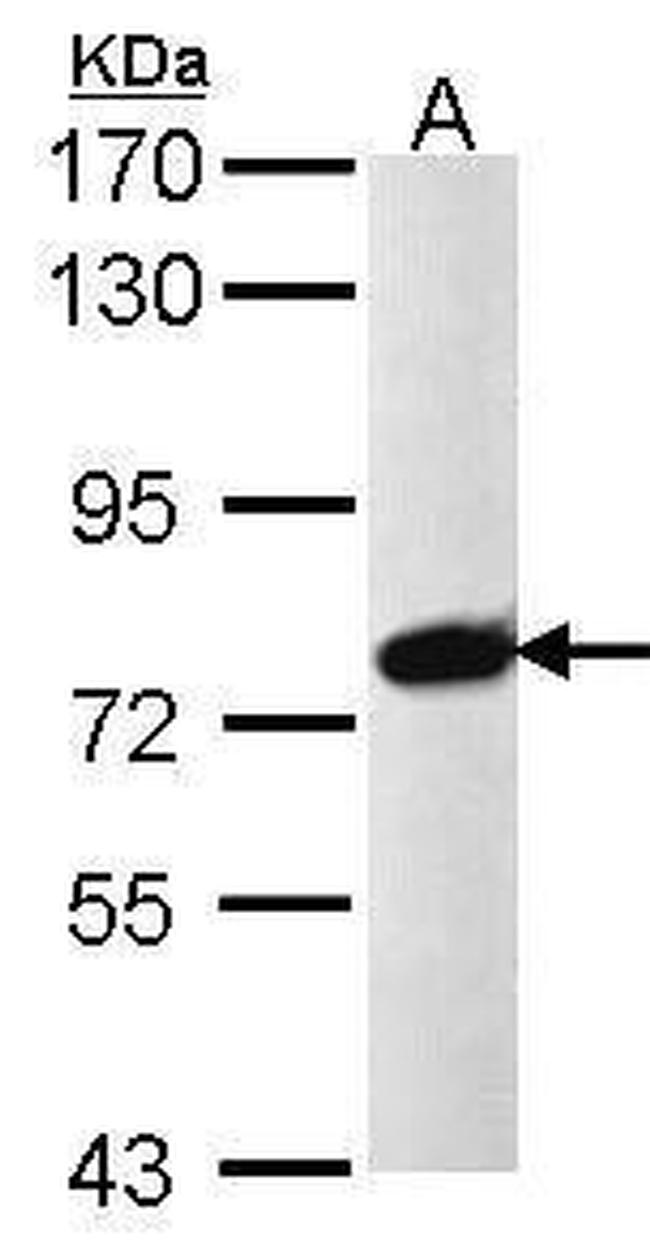 PRPF39 Antibody in Western Blot (WB)