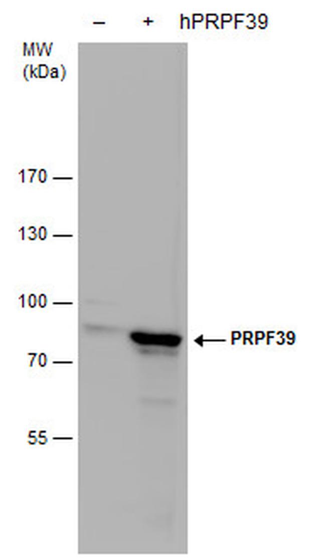 PRPF39 Antibody in Western Blot (WB)