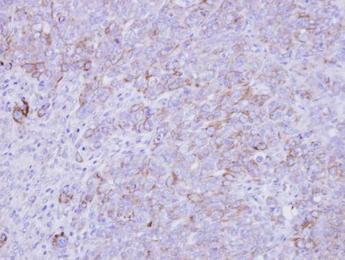 SLC26A8 Antibody in Immunohistochemistry (Paraffin) (IHC (P))