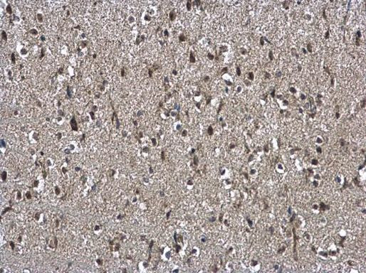 NSFL1C Antibody in Immunohistochemistry (Paraffin) (IHC (P))