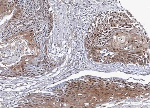 NSFL1C Antibody in Immunohistochemistry (Paraffin) (IHC (P))