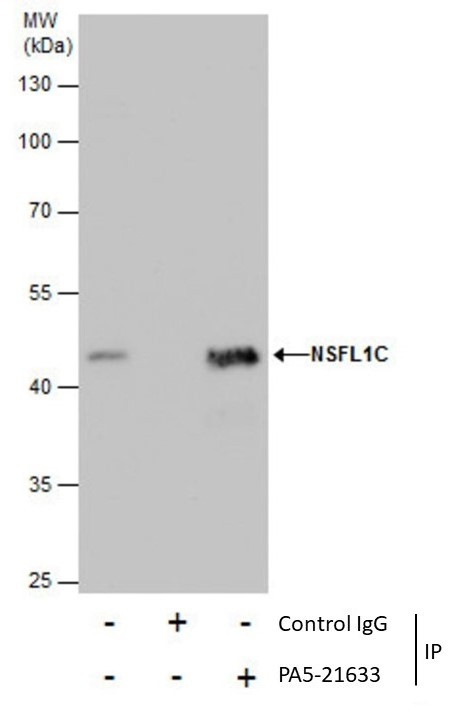 NSFL1C Antibody in Immunoprecipitation (IP)