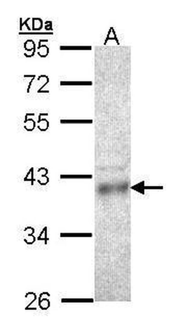 CPOX Antibody in Western Blot (WB)