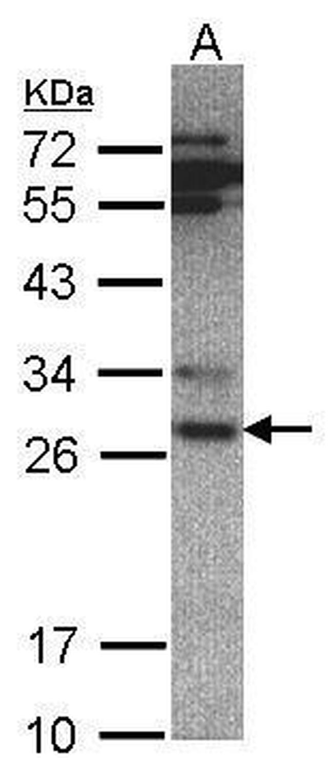 PSMA6 Antibody in Western Blot (WB)