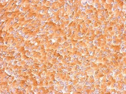 EMAP II Antibody in Immunohistochemistry (Paraffin) (IHC (P))