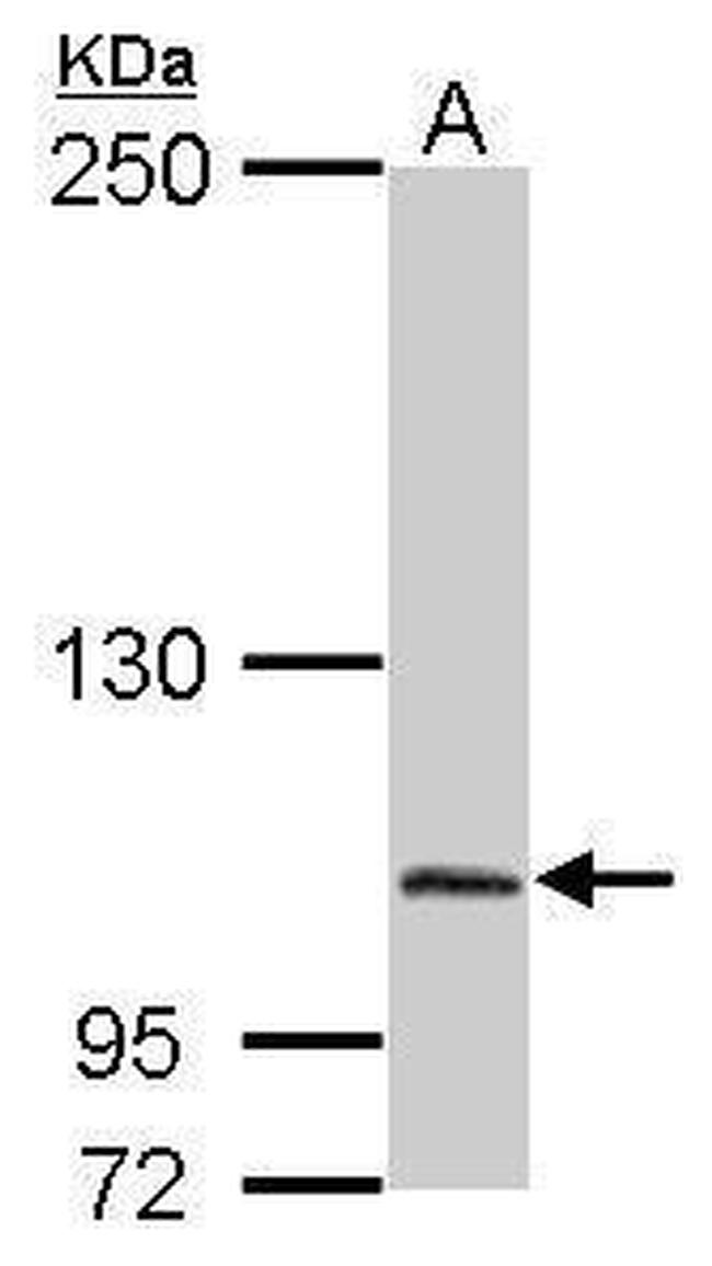 DPP8 Antibody in Western Blot (WB)