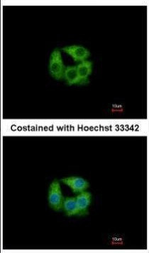 PCCB Antibody in Immunocytochemistry (ICC/IF)