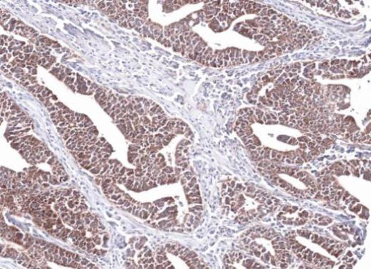 PCCB Antibody in Immunohistochemistry (Paraffin) (IHC (P))