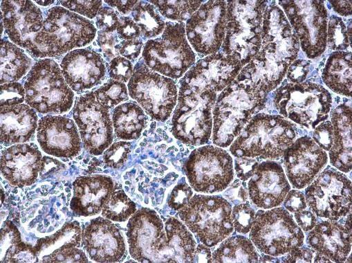 PCCB Antibody in Immunohistochemistry (Paraffin) (IHC (P))