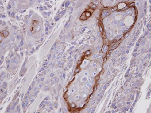 TPL2 Antibody in Immunohistochemistry (Paraffin) (IHC (P))