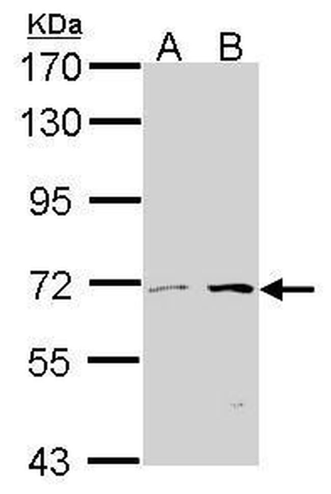 TPL2 Antibody in Western Blot (WB)