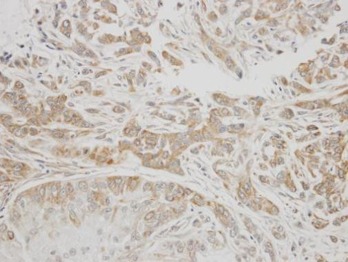 C1 inhibitor Antibody in Immunohistochemistry (Paraffin) (IHC (P))