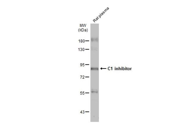 C1 inhibitor Antibody in Western Blot (WB)