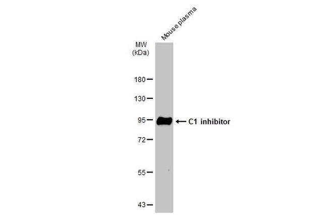 C1 inhibitor Antibody in Western Blot (WB)