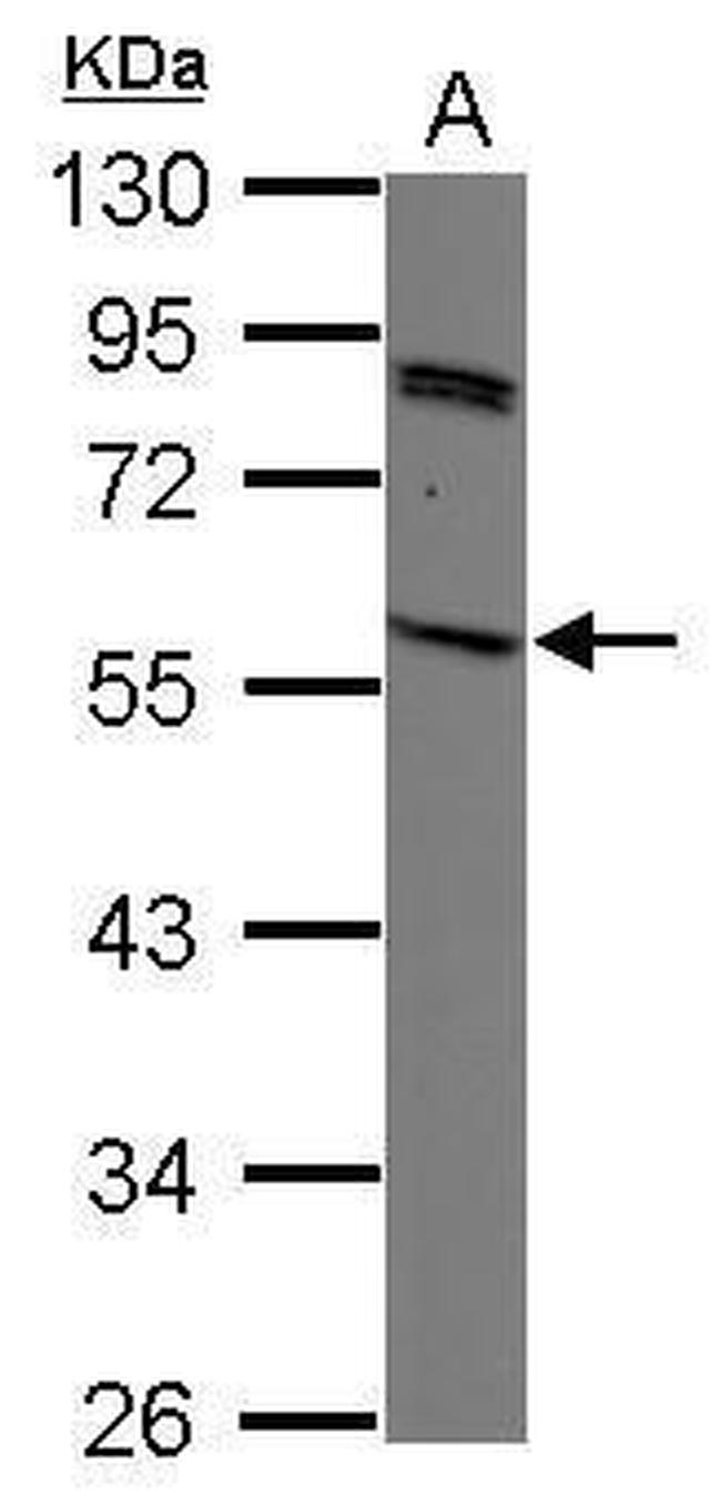 SIRP gamma Antibody in Western Blot (WB)