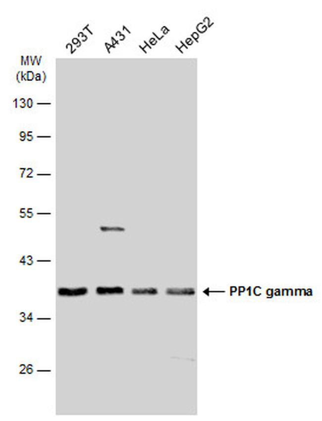 PP1 gamma Antibody in Western Blot (WB)