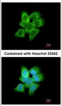 AKR1C1 Antibody in Immunocytochemistry (ICC/IF)