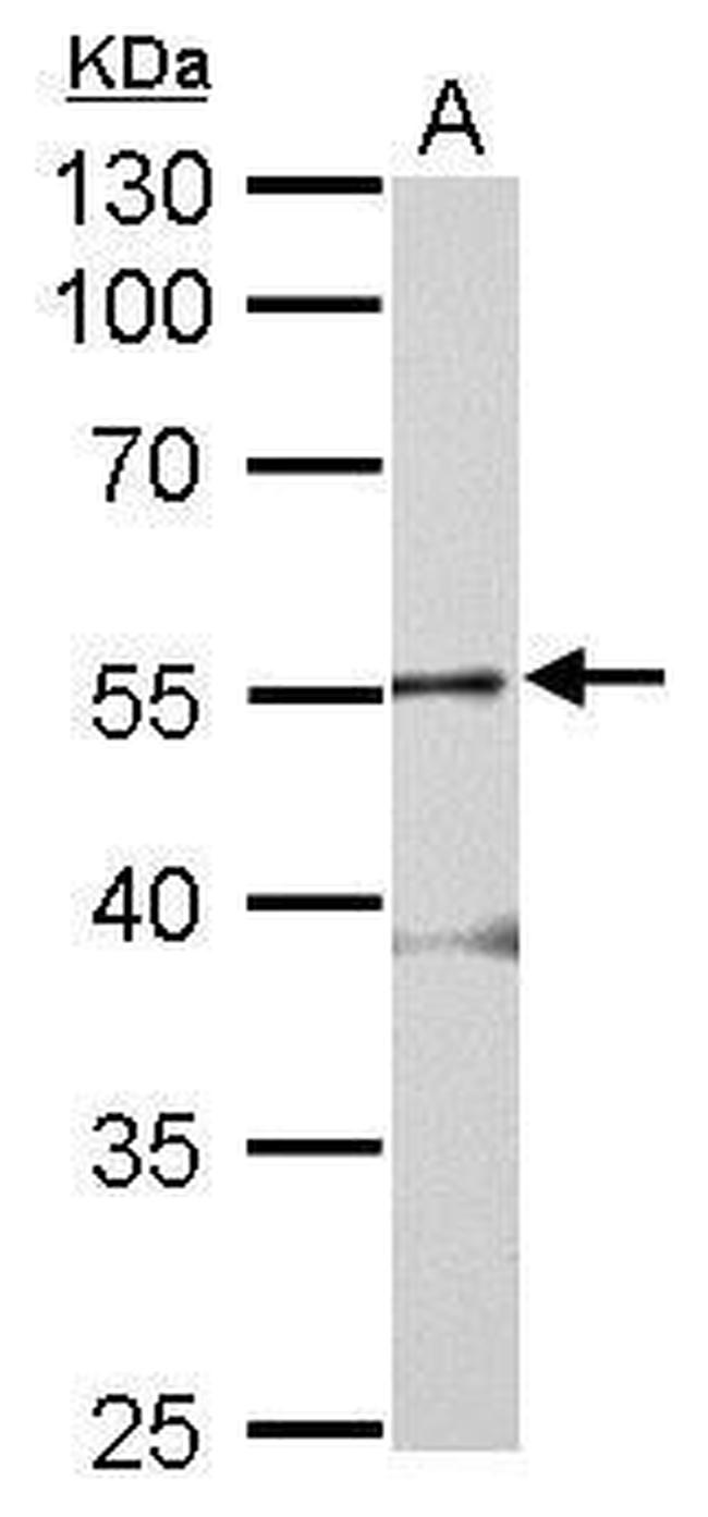 GLRA2 Antibody in Western Blot (WB)