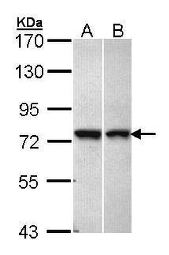 VPS51 Antibody in Western Blot (WB)