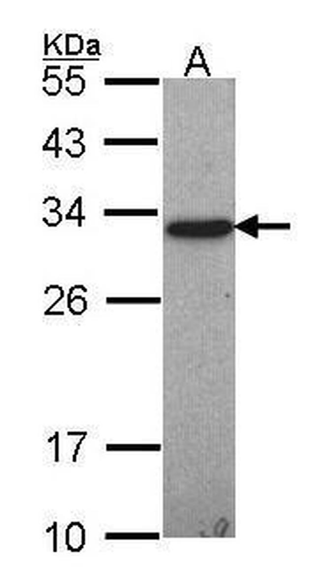 GST Omega 1 140A Antibody in Western Blot (WB)