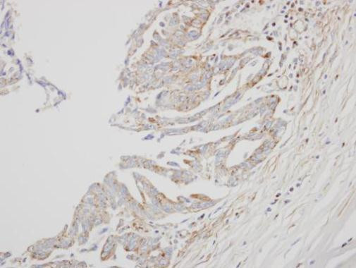 Interferon alpha-8 Antibody in Immunohistochemistry (Paraffin) (IHC (P))