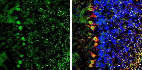 NCKAP1 Antibody in Immunohistochemistry (Frozen) (IHC (F))