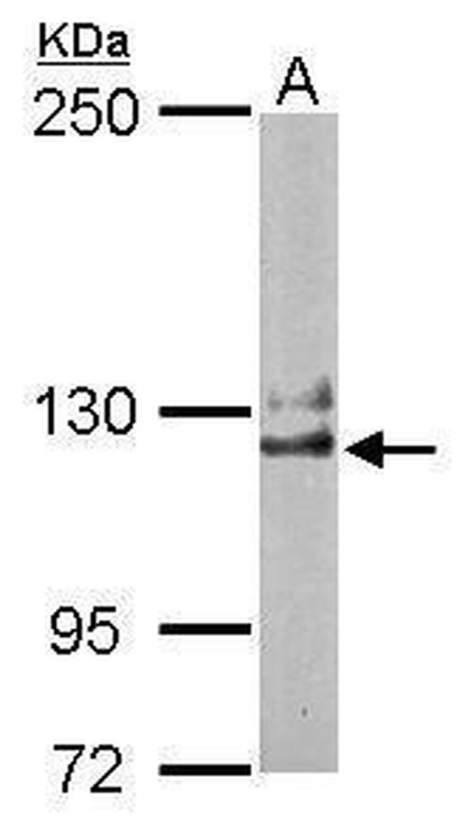 NCKAP1 Antibody in Western Blot (WB)