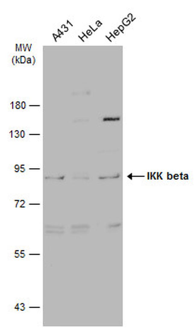 IKK beta Antibody in Western Blot (WB)