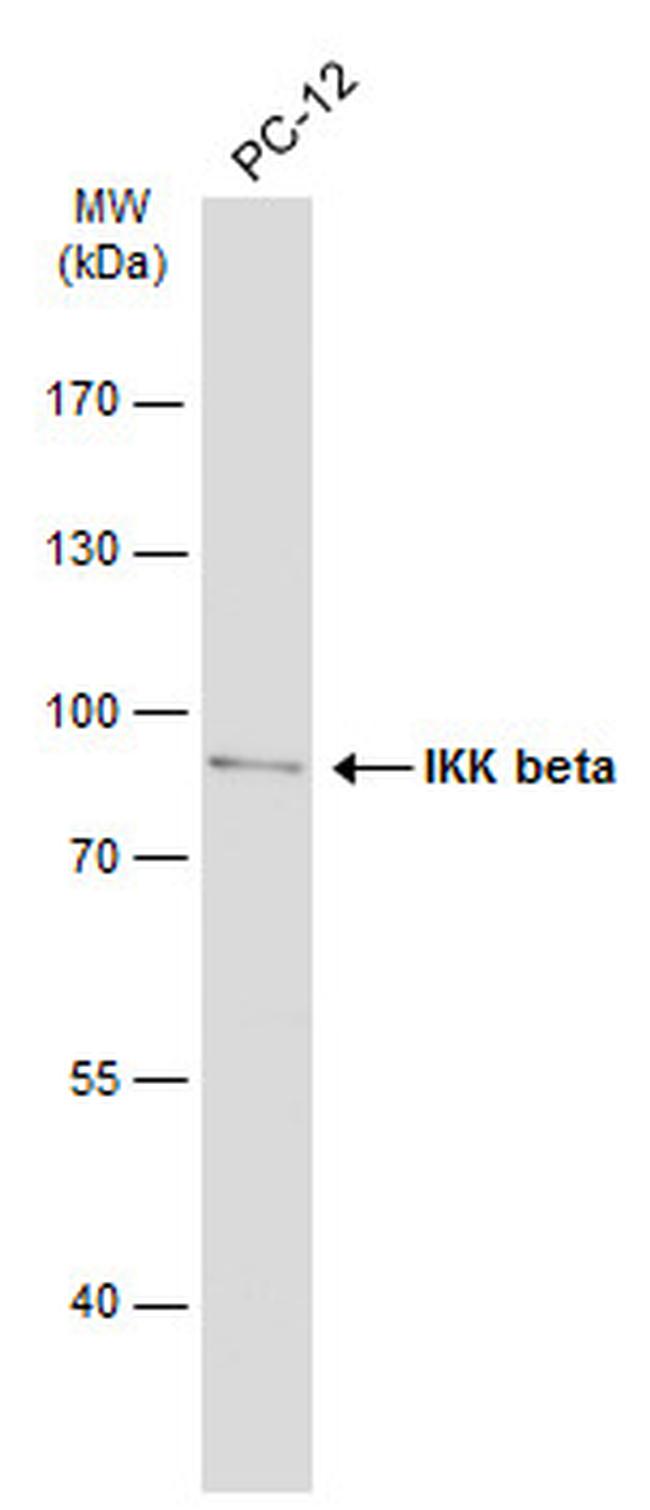 IKK beta Antibody in Western Blot (WB)