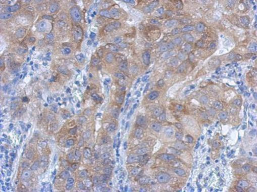 IKK beta Antibody in Immunohistochemistry (Paraffin) (IHC (P))