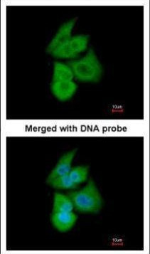 PFKL Antibody in Immunocytochemistry (ICC/IF)