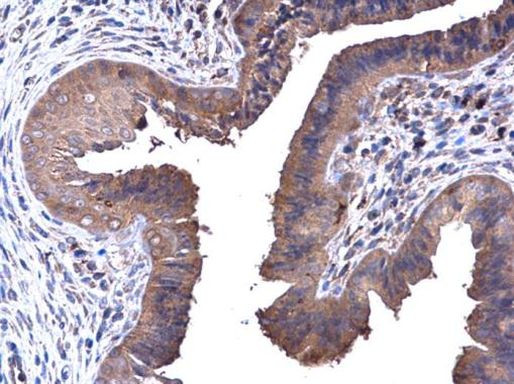 PFKL Antibody in Immunohistochemistry (Paraffin) (IHC (P))