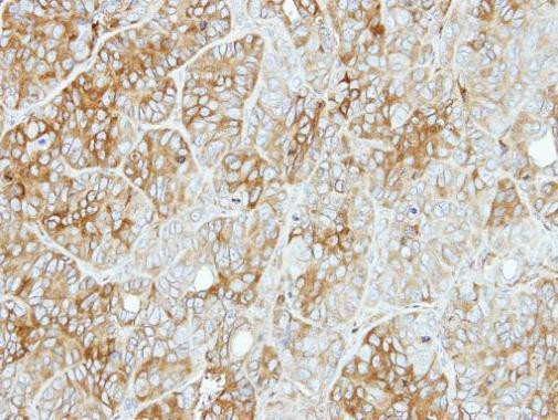 PFKL Antibody in Immunohistochemistry (Paraffin) (IHC (P))