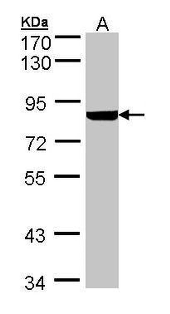 PFKL Antibody in Western Blot (WB)