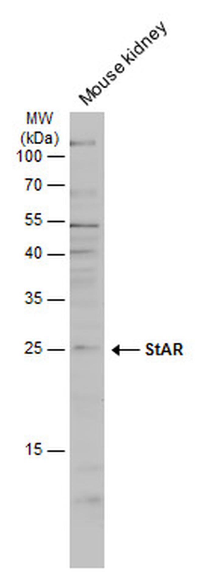 STAR Antibody in Western Blot (WB)