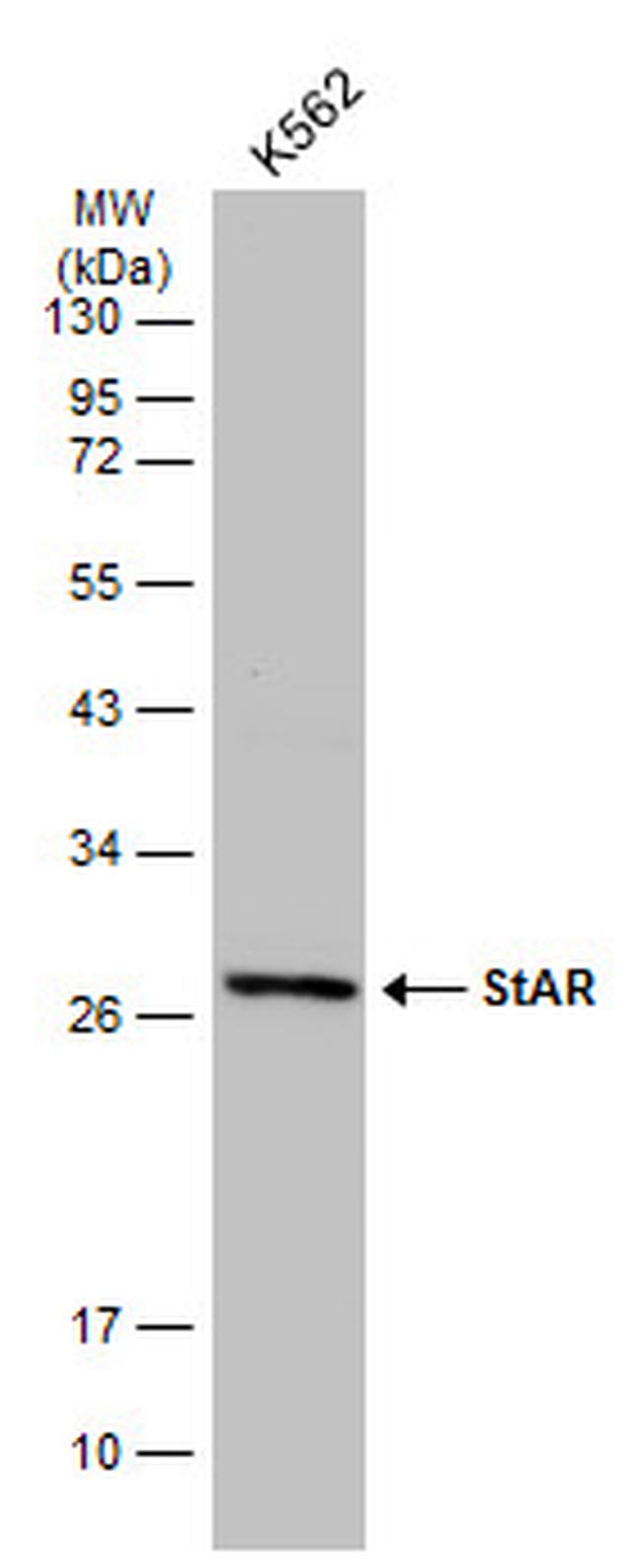 STAR Antibody in Western Blot (WB)