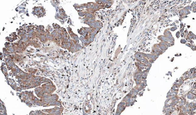 NT5C2 Antibody in Immunohistochemistry (Paraffin) (IHC (P))