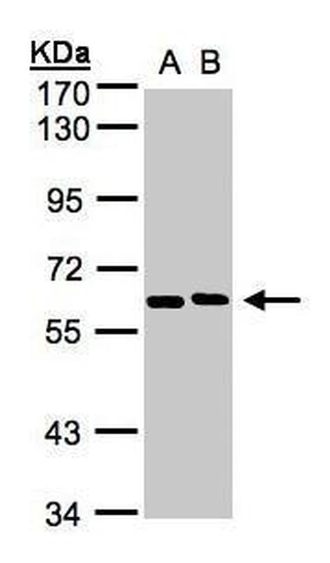 NT5C2 Antibody in Western Blot (WB)