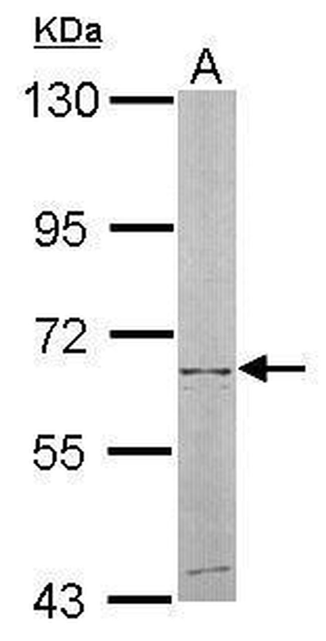 NT5C2 Antibody in Western Blot (WB)